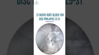 S1 Nerve Root Injection For Disc Prolapse  L5 S1 Under Fluoroscopy Guidance [upl. by Ydnis837]