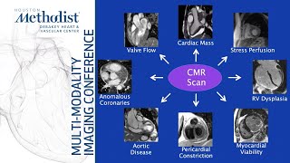 Cardiovascular Examination  OSCE Guide  UKMLA  CPSA  PLAB 2 [upl. by Ingaborg461]