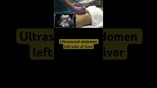 Ultrasound Abdomen left liver lobe [upl. by Gayel]