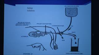 Bovine Embryo Transfer Facts2 Conventional Flush Method [upl. by Carola]