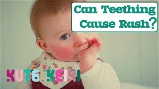 Can Teething Cause Rash in Babies  Natural Teething Rash Remedies [upl. by Nath]