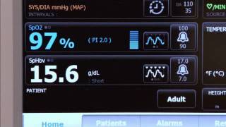 How To Taking a Pulse Oximetry Reading with Welch Allyn Connex Integrated Devices [upl. by Flory803]