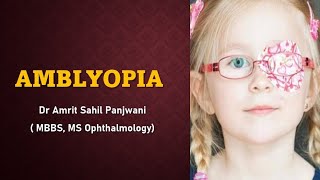 AMBLYOPIA  lazy eye EXPLAINED [upl. by Ssur]