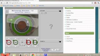 Retinoscopy Simulator Tutorial SPHCYL Method [upl. by Eugnimod]