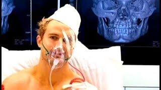 Sage Northcutt vs Cosmo Alexandre Facial bone fracture [upl. by Aivatra]