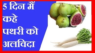 5 दिन मैं कहे पथरी को अलविदा  गुर्दे की पथरी की चमत्कारी दवाई  KIDNEY STONE HOME REMEDIES [upl. by Bryanty108]