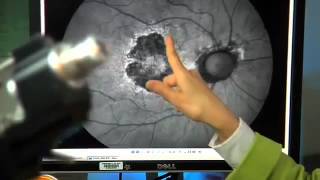 Meet an Ophthalmologist LifeWorks Careers [upl. by Malet7]