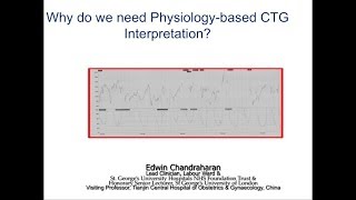 Why do we need Physiologybased CTG Interpretation [upl. by Marcille]