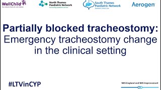 Partially blocked tracheostomy Emergency tracheostomy change in the clinical setting [upl. by Jourdan]