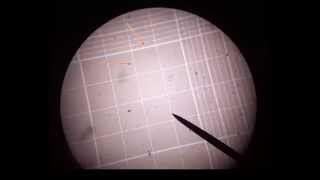 How to use a Hemocytometer [upl. by Len]