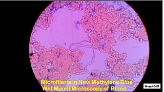 Microfilaria in blood Microscopy [upl. by Fayre]