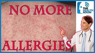 Top 10 HOME REMEDIES to Cure SKIN ALLERGIES NATURALLY [upl. by Beckie]