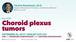 Choroid plexus tumors  Dr Rodriguez Hopkins NEUROPATH [upl. by Nekciv999]