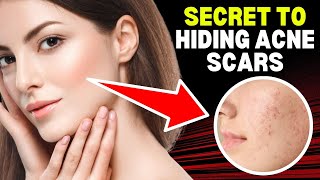 Magic Makeup Trick to Hide Acne Scars NATURALLY ✨💄 [upl. by Eerok124]