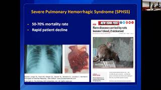 Leptospirosis Clinical Disease and Diagnosis in Humans [upl. by Duma]