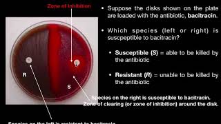 Optochin Susceptibility Test Procedures and Interpretation of Results [upl. by Ynahpets]