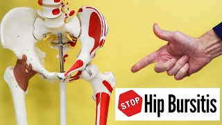 STOP Hip Bursitis Pain Without Seeing A Dr or Having Injection [upl. by Estrella]