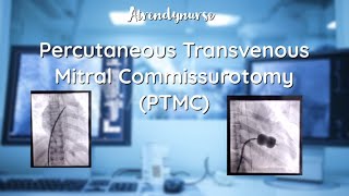 Procedure Percutaneous Transvenous Mitral Commissurotomy PTMC [upl. by Daniella]