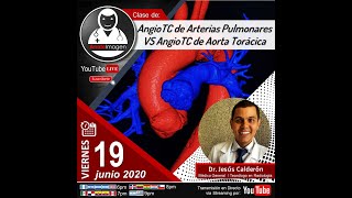 AngioTC de Aorta Vs AngioTC de Arterias Pulmonares  Esp Jesús Calderón [upl. by Hillery307]