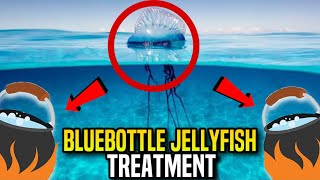 Bluebottle Jellyfish Stings What You Need to Know amp How to Treat Them [upl. by Oryaj]