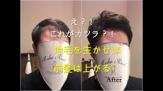 メンズ部分かつら・ウィッグ！地毛を生かして前髪上げよう！ [upl. by Danila]