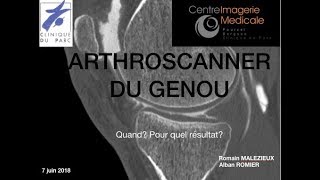 Arthroscanner du genou Alban ROMIER [upl. by Shanie]