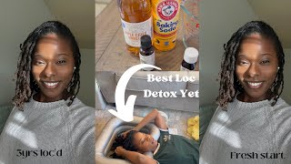 Detoxing Locs to get rid of buildupACV Rinse [upl. by Egroej395]