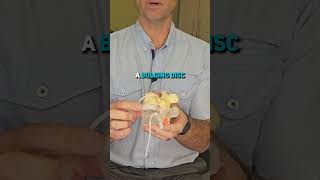 How does nerve compression from a herniated disc cause leg pain [upl. by Ahsirk613]