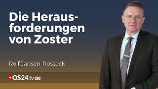 Zoster erklärt Vom Windpockenvirus zur schmerzhaften Gürtelrose  Unter der Lupe  QS24 [upl. by Bittner]