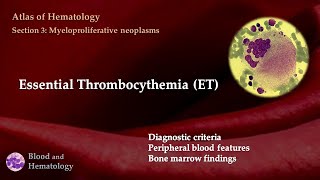 Essential Thrombocythemia ET [upl. by Odelet]