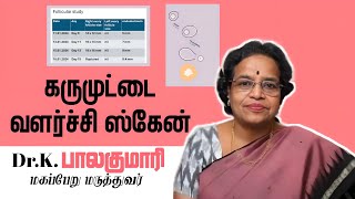 Follicular study  கரு முட்டை வளர்ச்சி ஸ்கேன் [upl. by Myrah707]