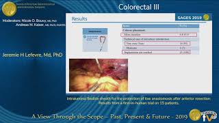 Intraluminal flexible sheath for the protection of low anastomosis after anterior resection [upl. by Widera192]