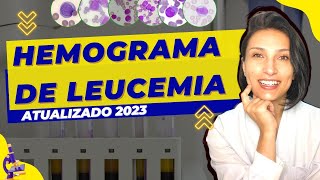 Hemograma Completo de Leucemia  ATUALIZADO 2023  Células Sanguineas  Biologia  Biomedicina [upl. by Eimarrej]