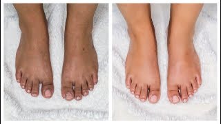 How to do PEDICURE at Home  Summer Ready Feet in Minutes [upl. by Myrvyn]