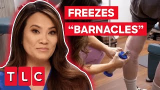 Dr Lee FREEZES “Barnacles” Off Man’s Skin  Dr Pimple Popper This Is Zit [upl. by Nnair]