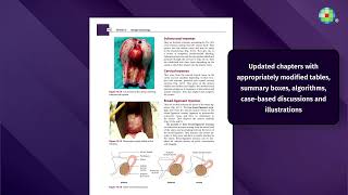 Essentials of Gynecology Third Edition [upl. by Hcirdla]