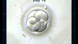 EMBRYO DEVELOPMENT UP TO BLASTOCYST [upl. by Enilrac700]