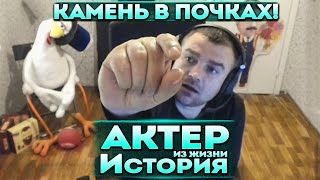 Актер  История  Как выходил камень из почек [upl. by Aldora]