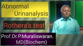 Rotheras test Muralis Simplified Biochemistry [upl. by Sandro]