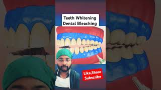 Teeth whitening Process 3D Animation Bleaching yt shorts ytshorts animation teethwhitening [upl. by Atinrehs]