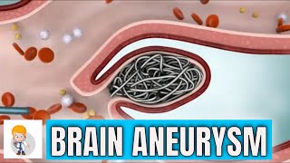 Brain cerebral Aneurysm Types symptoms and surgical repair [upl. by Tray]