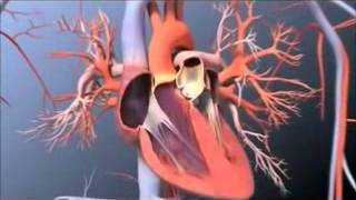 Pulmonary Artery Catheterization [upl. by Rye]