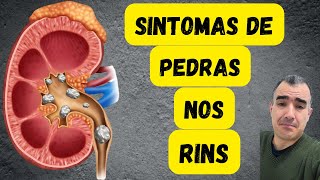 Sintomas de pedra nos rins [upl. by Ossy]