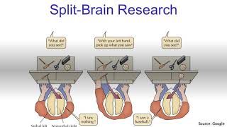 Split Brain SyndromeExplained [upl. by Chapman587]