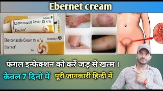 Ebernet cream use benefits and Side effects full review in hindi [upl. by Peppy]