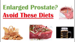 Foods to Avoid with Enlarged Prostate  Reduce Symptoms and Risk of Prostate Cancer [upl. by Hgielah]