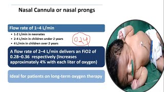 Oxygen Therapy  Pediatrics [upl. by Nayra550]