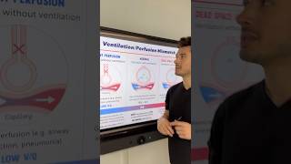 VQ Mismatch in 60s from my Pulmonology Guide📘medschool medstudent usmle usmlestep1 step1 [upl. by Assirac]