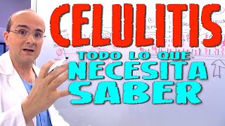 CELULITIS  Todo lo que necesita saber  Enfermedades 17 [upl. by Davidson759]