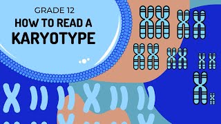 How to read a karytoype  What is a autosome and gonosome [upl. by Eeltrebor934]